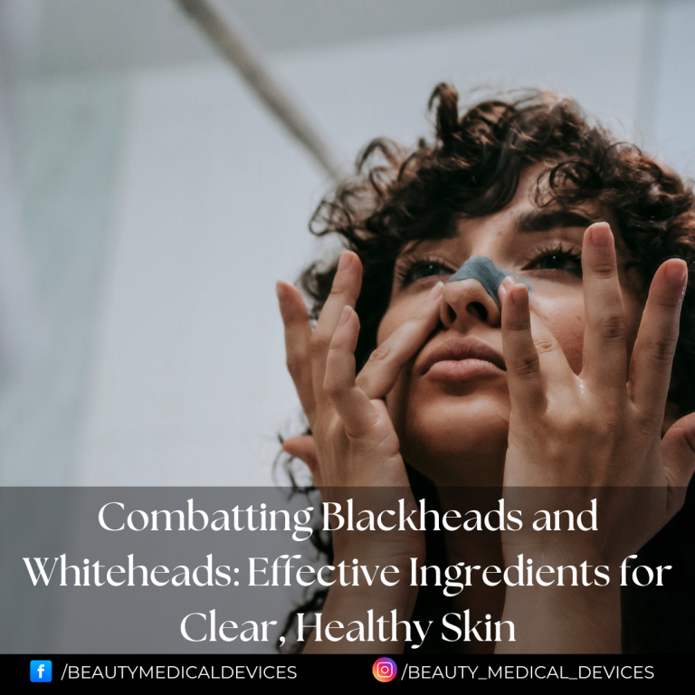Combatting Blackheads and Whiteheads: Effective Ingredients for Clear, Healthy Skin