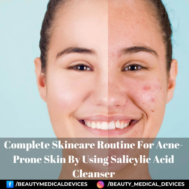 Complete Skincare Routine For Acne-Prone Skin By Using Salicylic Acid Cleanser