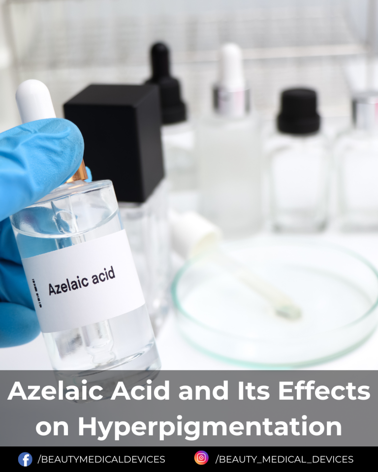Azelaic Acid and Its Effects on Hyperpigmentation